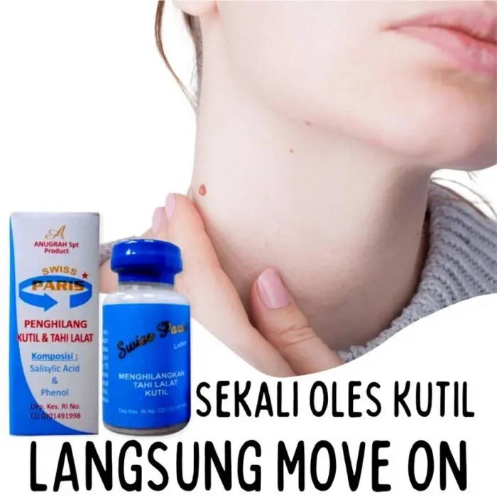 Swiss Paris Obat Oles Penghilang Kutil Tahi Lalat , Butir & Mata Ikan