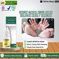 Gambar Propolis SM - Untuk Gatal Kutu Air Di Sela Jari Kaki Dan Telapak Kaki, Gatal Ruam Berisi Cairan dari Bashirah Herbal Kota Administrasi Jakarta Pusat 1 Tokopedia
