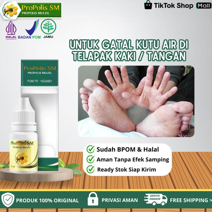 Gambar Propolis SM - Untuk Gatal Kutu Air Di Sela Jari Kaki Dan Telapak Kaki, Gatal Ruam Berisi Cairan dari Bashirah Herbal Kota Administrasi Jakarta Pusat Tokopedia