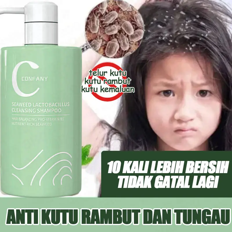 Shampoo Penghilang Ketombe Shampoo Psoriasis Anti Ketombe Dan Gatal Garam Laut Sampo Ketombe Shampoo Kutu Rambut Pengobatan Tungau Kulit Kepala Kering Dan Ketombe Mengontrol Minyak 2