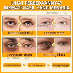 Eye Cream BPOM Menghilangkan Mata Panda Penghilang Kantung Mata Krim Mata 20g Honey Eye Cream Memudar Lingkaran Hitam Hidrasi Dan Pelembab Memperbaiki Keriput Mata Pencerah Kantung Mata Krim Pemutih Kantung Mata