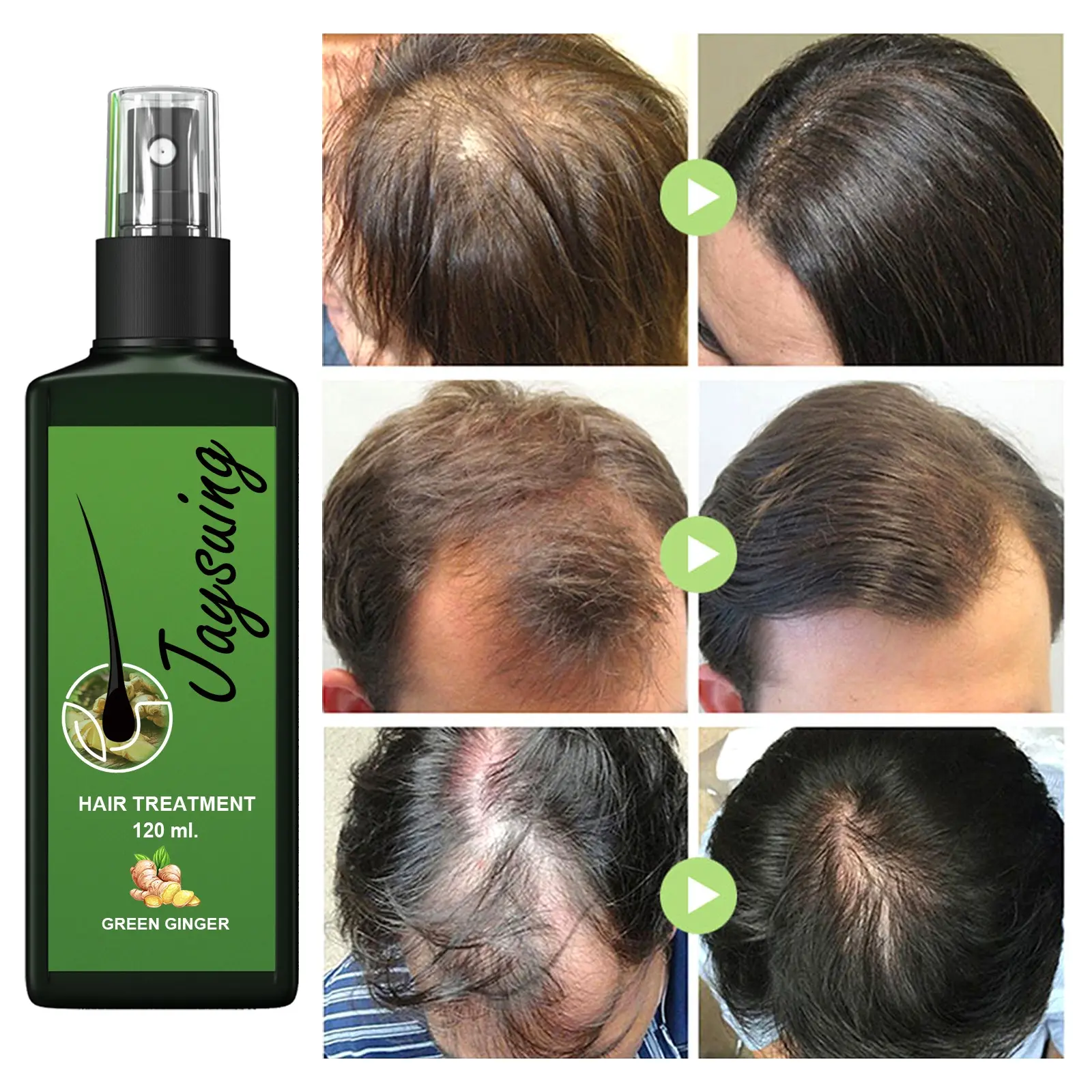 jaysuing ginger hair growth spray penumbuh rambut cepat serum penumbuh rambut botak hair tonic rambut rontok 120ml