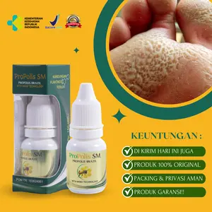 Propolis Sm - Kaki Rayapan Removal Di Bersihkan