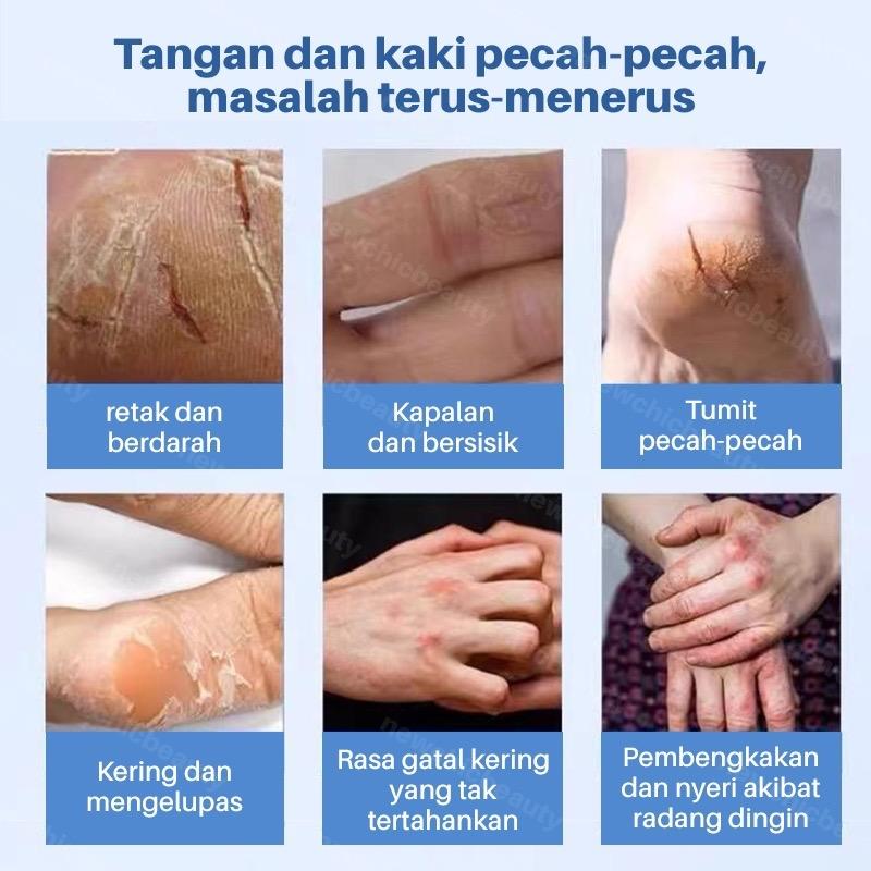 HIH Original Pelembab dan Perawatan Retak Tumit dan Cream Kaki Kapalan Cream Kaki Pecah pecah Ultra Moisturizing Cream Stick Melembutkan dan Menghaluskan Tumit Kaki Original 40gr 4