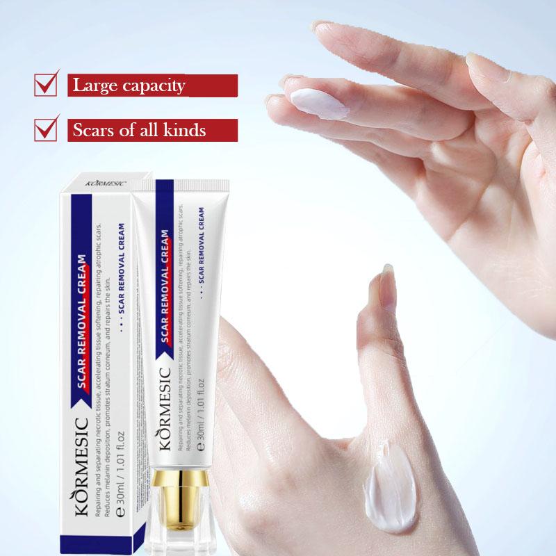 KORMESIC Kem Đặc Trị Sẹo Lồi Sẹo Thâm Sẹo Cũ Làm Mờ Vết Thâm Do Mụn Và Côn Trùng Cắn Phục Hồi Vùng Da Tổn Thương 30ml Hot Sale