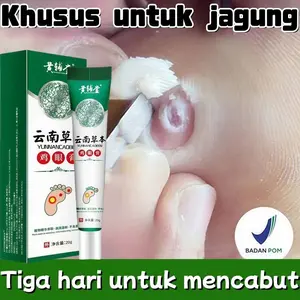 Salep mata ikan 20g salep kutil kapalan kaki untuk menghilangkan kutil penutup mata ikan obat kapalan salep kutu mata ikan