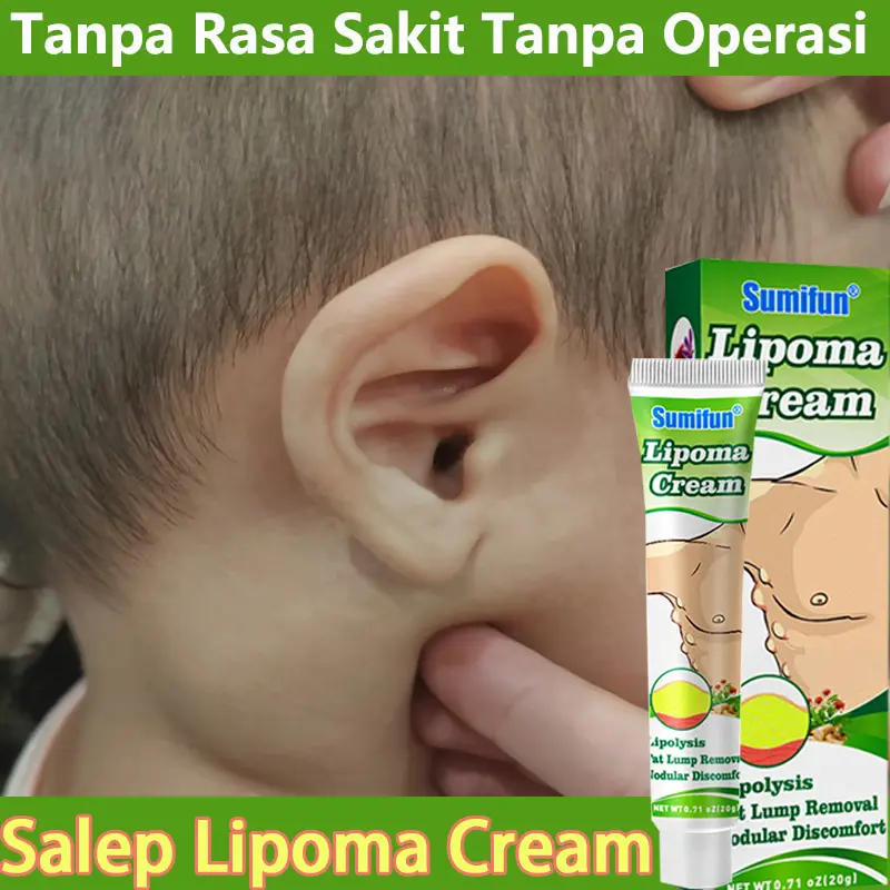 COD Lipoma Cream Lipoma Lump Medicine jinak lipoma lump cream Lump Cream on the Neck Hand Armpit Lump on the Neck Body 20G