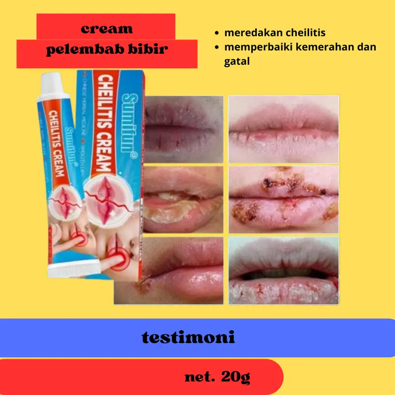 SUMIFUN Cheilitis Cream Bibir Moisturizing Pelembab Bibir Peradangan Kulit Pada Area Bibir Herpes Di Bibir Kering Dan Bibir Pecah 1