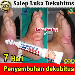Krem pelembap tubuh melembapkan Luka Diabete Skrim Dekubitus Mengobati Dekubitus 20g Penyembuhan Luka Khusus Pembusukan Kaki BEDSORE CREAM / Krim Luka Baring / Penyembuh Luka Diabetes / Mengobati Luka Dekubitus
