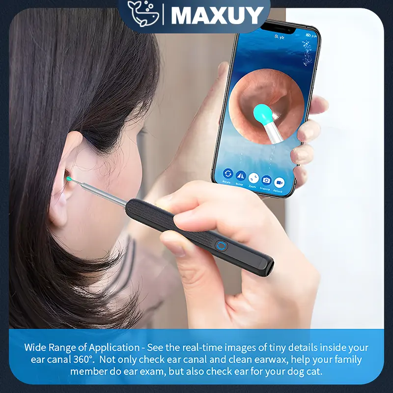 Pembersih telinga bayi korek kuping LED kamera WiFi hp korek kuping bayi pembersih kuping smart Non-Medis Black