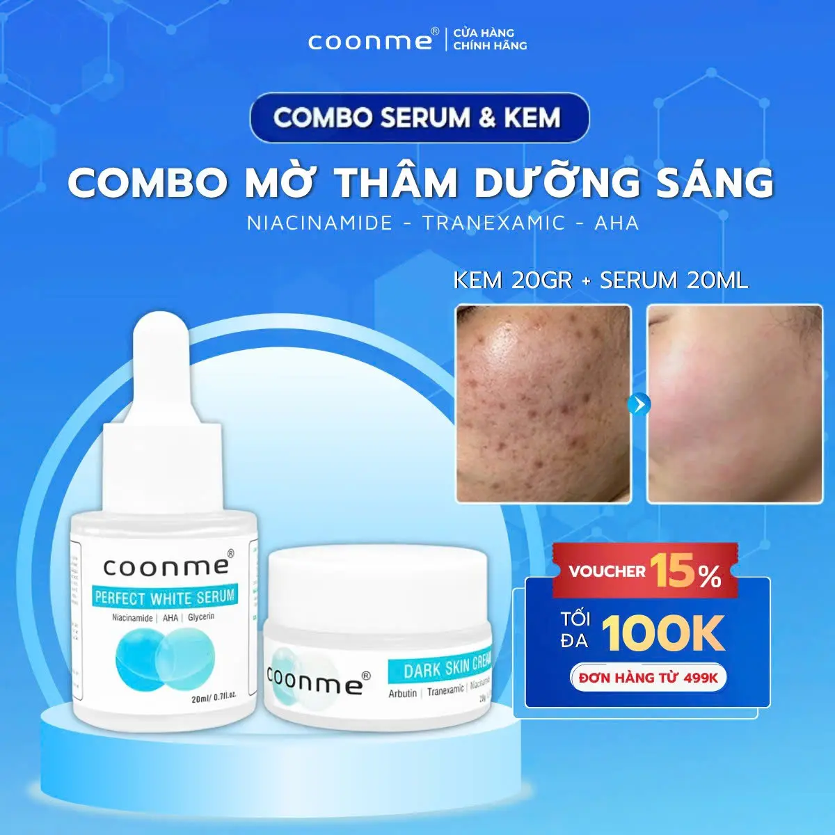 COONME combo mờ thâm gồm SERUM (Perfect white serum) 20ml + Kem ( Dark skin cream) 20g hỗ trợ mờ thâm lâu năm thâm đỏ, thâm đen, thâm do mụn dưỡng sáng da Skincare