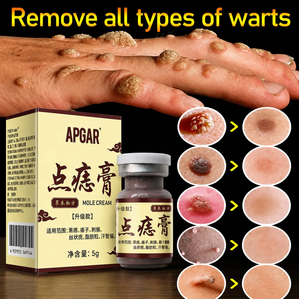 【Pengiriman Rahasia】Obat Kutil paling Penghilang Perawatan herbal Kutil manjur tanpa operasi mahal penghapus menghapus keloid Krim Penghilang Oles Kutil, Kutil di Leher, Kutil di Tangan, Kutil di Ketiak, Oles Penghilang