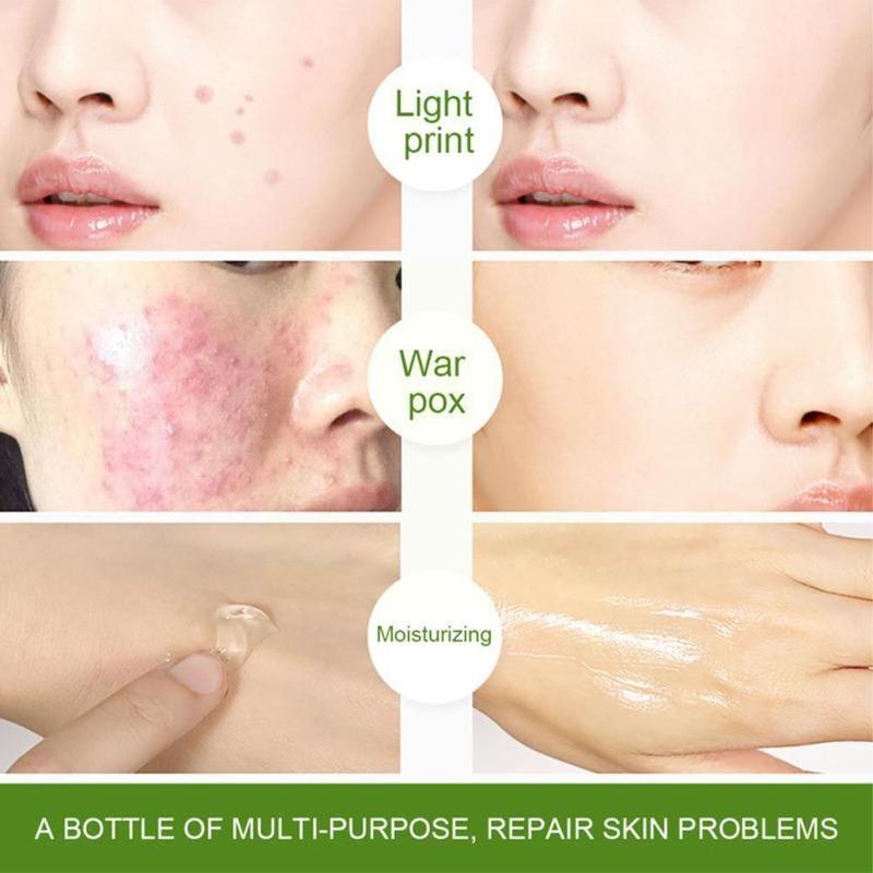 BPOM CINDYNAL Aloevera Ointment 92 % Gel Murni Natural Masker Lidah Buaya Korea 4