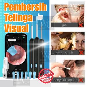 Alat Pembersih Telinga Pintar Tanpa Wayar Lampu Bercahaya Kamera HD Endoskop Alat Penggali Lilin Hujung Silikon Selamat Keluarga Wireless Smart Visual Ear Picker LED Illumination Rechargeable Endoscope Ear Cleaner Silicone Tip Earwax Remover Safe and Easy