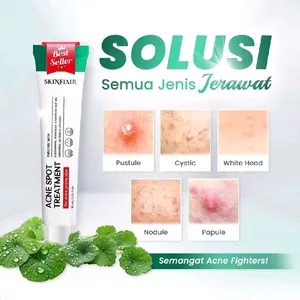 [BPOM] SKINFLAIR ACNE SPOT TREATMENT MENGATASI JERAWAT OBAT JERAWAT KEMPES DALAM 24 JAM