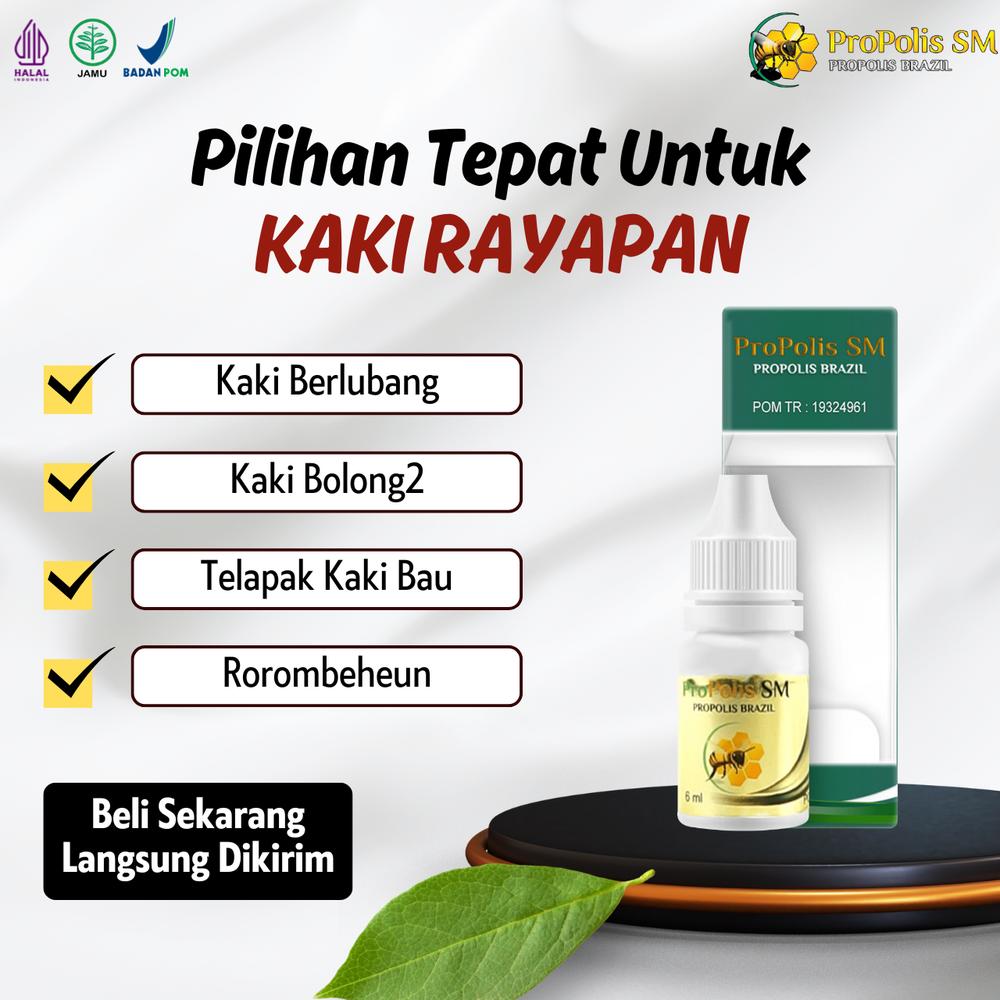 Oles Propolis SM Untuk Kaki Gatal Telapak Kaki Bolong dan Bau Kaki Rayapan Telapak Kaki Berlubang Rorombeheun Korodok - 1 Botol