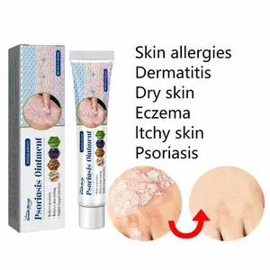 Salep Psoriasis 20 Gram untuk Menghilangkan Gatal dengan Cepat, Memperbaiki Kulit