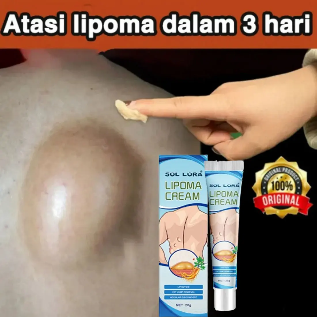 Original Lipoma Cream Ointment 20g lipoma cream ointment lump Neck Lump / Lump on the Saliva Gland