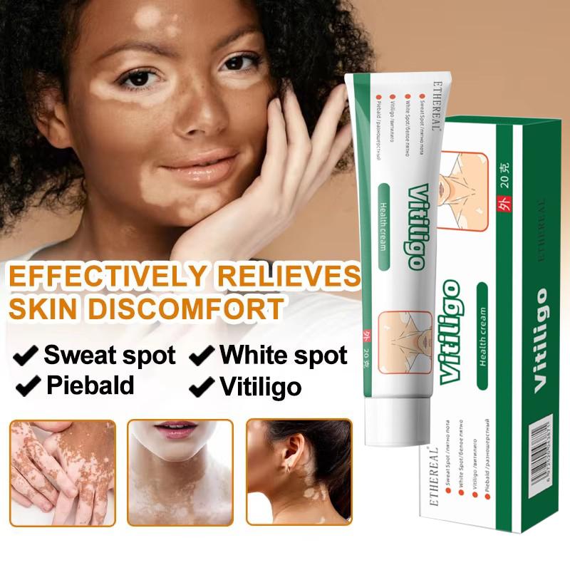 Obat Penghilang Vitiligo Salep Krim Vitiligo Bintik Putih Salep vitiligo Obat vitiligo untuk kulit bercak putih jerawat keringat  krim concealer noda melanin salep khusus vitiligo