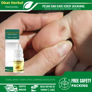 Solusi Untuk Mengatasi Kutil Mata Ikan,  Mata Ikan Telapak Kaki dan Tangan, Penghilang Mata Ikan, Kaki Kapalan, Kaki Pecah - Pecah Atasi Dengan Propolis sm