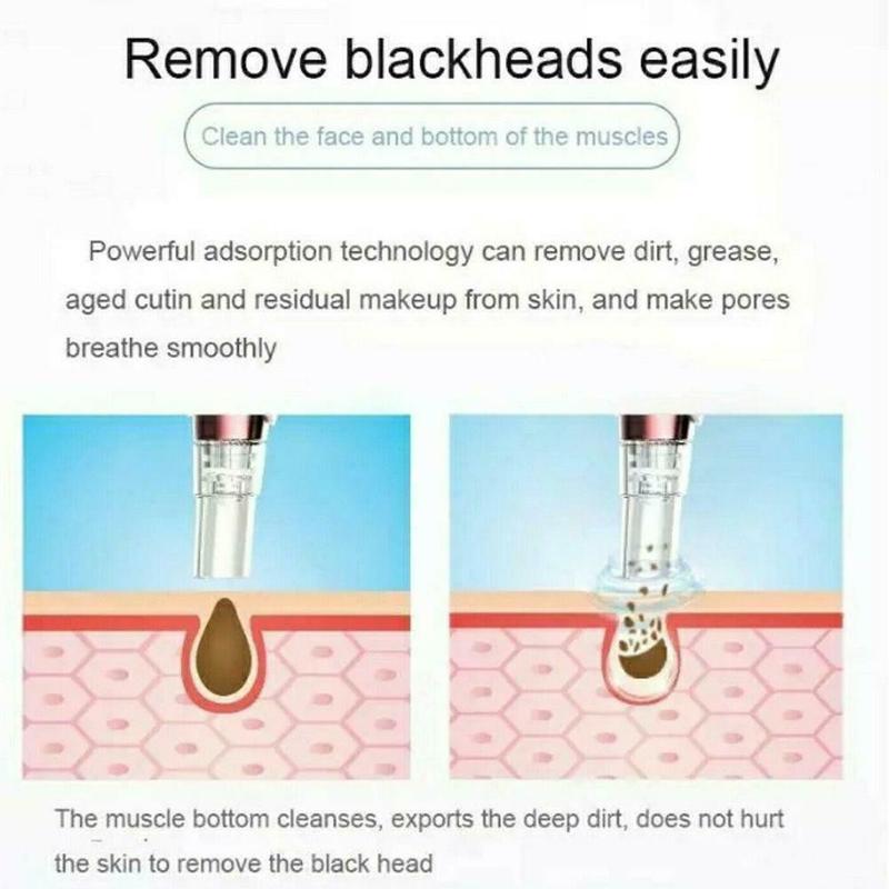 Alat Penyedot Komedo dan Jerawat Vacum Alat Facial Perawatan Wajah 6