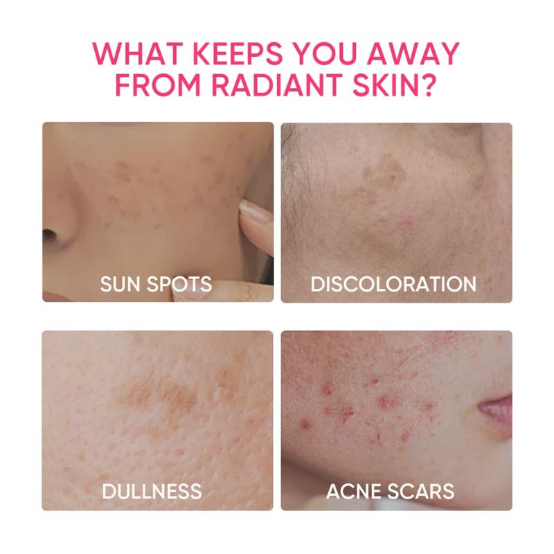 Product Introduction of SKINTIFIC MSH Niacinamide whitening Gel moisturiser Glowing Moisturizer Fades Dark Spot Cream 2