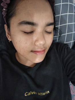 Product Review of [opy] DOSIS 2 - Paket Retinol Booster Cysteamine / Antioxidant from @**4 3