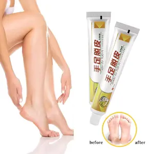 Salep Obat Cina AMPUH Kaki Pecah-pecah Tangan Krim Tumit Pecah-pecah Mengupas Kaki dan Tangan (Skin Peeling Cream)