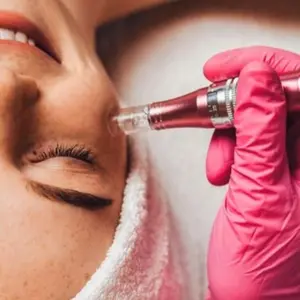 HYDRAPEN TREATMENT WAJAH SCAR BOPENG Facial