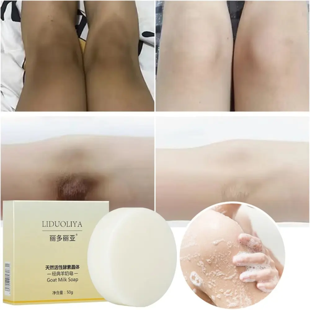 Removal Dead Skin Body Whitening Soap Body Treatment Moisturizing Deep Clean Goats Milk Soap Body Brighten Chicken Skin Removal White Care Products for Underarm Knees