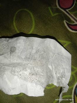 Product Review of Masker komedo AllPhv Blackhead Remover Mask Step 1 & Step 2 (Masker pembersih komedo) Treatment from N**a L**i 1