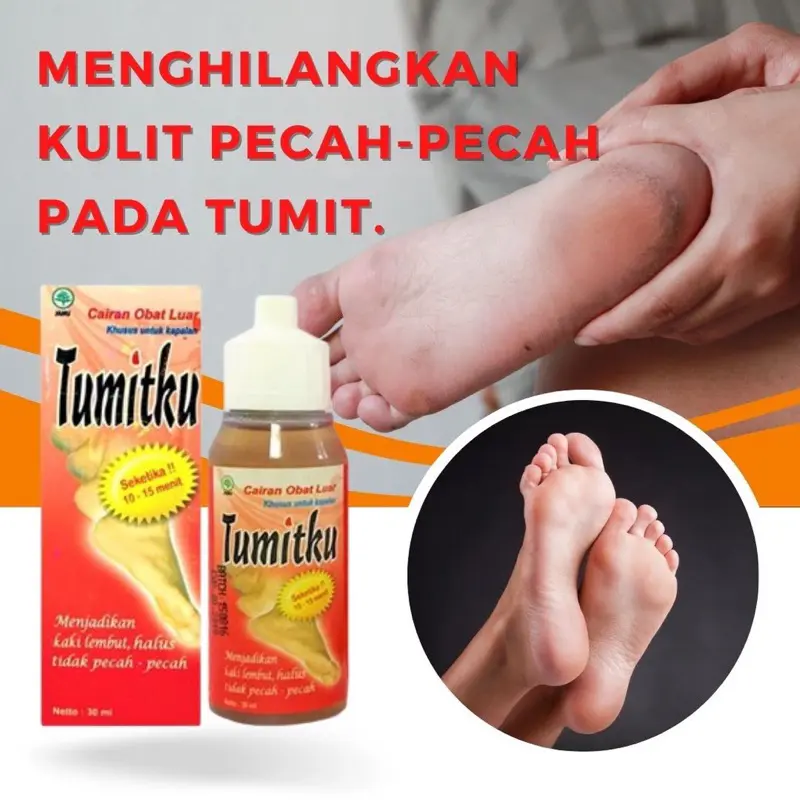 TUMITKU || TUMITKU - SOLUSI KAKI KAPALAN / PECAH 3