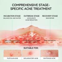 Gambar [OFFICIAL]LANBENA Acne Patch Malam & Siang – 4 Keunggulan Lawan Jerawat! Invisible, Percepat Sembuh,  1 Patch Bikin Jerawat Hilang! Tahan Air & Keringat, Anti Polusi, Cocok Pakai Sambil MakeUp - Acne patches [DAY] dari Lanbena.Indonesia Kab. Tangerang 4 Tokopedia