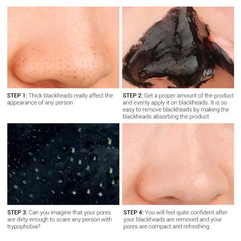 ZOOSON Masker Penghilang Komedo Hidung Blackhead Remover Wajah 4