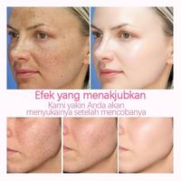 Gambar 【BPOM】Cream Pemutih Wajah Efektif Hilangkan Flek Hitam 20g anti-freckle Whitening Cream Penghilang Flek Hitam Membandel Niacinamide cream Siang Malam salep flek hitam Pemutih Wajah Krim Pemutih Penghilang Flek Hitam membandel - 20ML dari Sumifun Beauty Indonesia Kab. Bekasi 5 Tokopedia