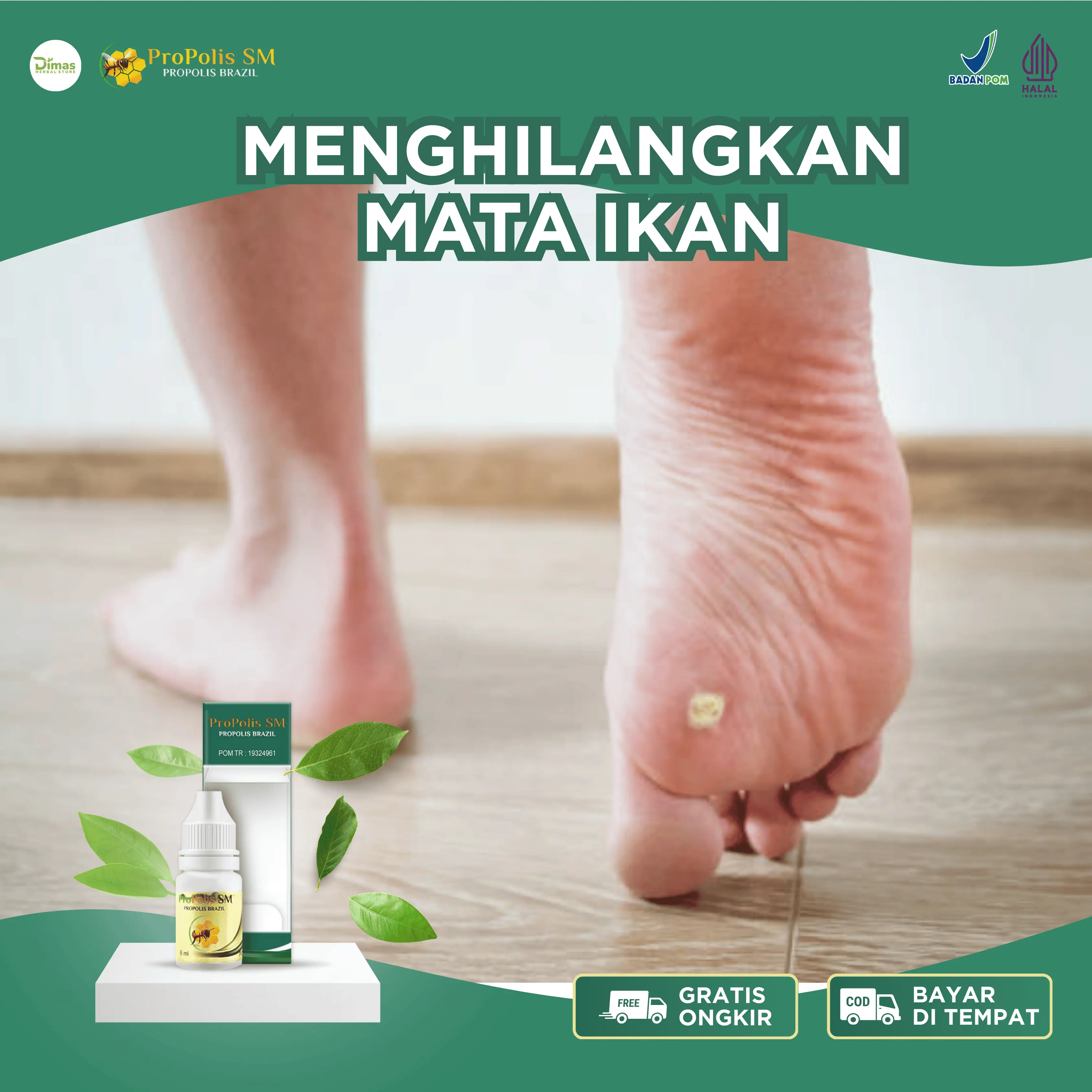 Penghilang Mata Ikan, Mata Ikan Di Kaki, Mata Ikan Di Tangan, Mata Ikan Di Jari, Mata Ikan Di Telapak Kaki, Mata Ikan Di Jari Tangan, Salep Mata Ikan Propolis SM