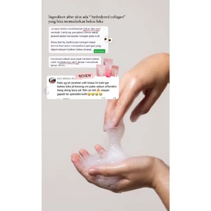 AFTERSKIN - 10x Alpha Arbutin Whitening Bodycream Bibit Chrome Premium HB Dosting Chromabright Lotion Hitam Kaki Ketiak Mencerahkan Scrub Tubuh Kehitaman Memudarkan Punggung Selangkangan Niacinamide Kusam 4
