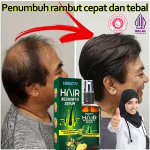 Hair Tonic Penumbuh Rambut botak serum rambut rontok rusak 30ml rambut rontok Pria dan wanita penumbuh rambut cepat
