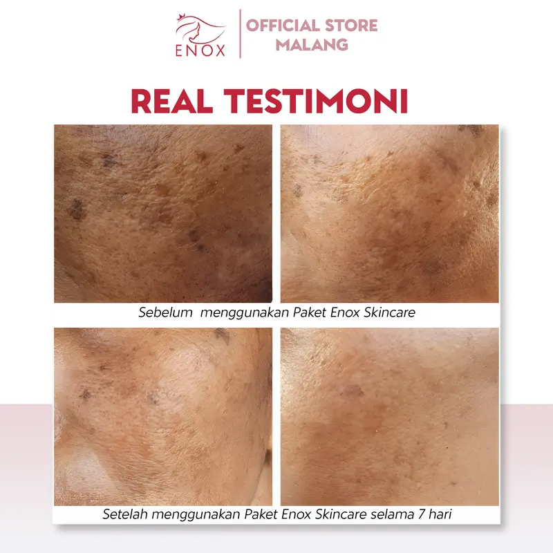 Enox Skincare - Brightening Glow Up Serum Anti Aging Mencerahkan Menyamarkan Kerutan dan Mengurangi Flek Hitam 4