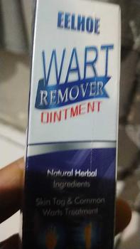 Product Review of Penghilang Kutil Wart Remover Skin Tag Remover Penghilang Tahi lalat Salep Penghilang Flek Hitam Perawatan from l**i g**d 0