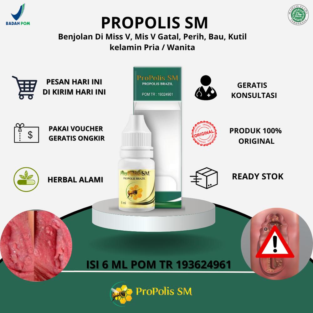 Propolis SM - Benjolan Di Miss V, Mis V Gatal, Perih, Bau, Kutil kelamin Pria / Wanita, Kista Bartholin, Infeksi Jamur Kelamin, Luka Di Kelamin, Infeksi Jamur Kista Ovarium Kista Denoma, Salep Gatal m