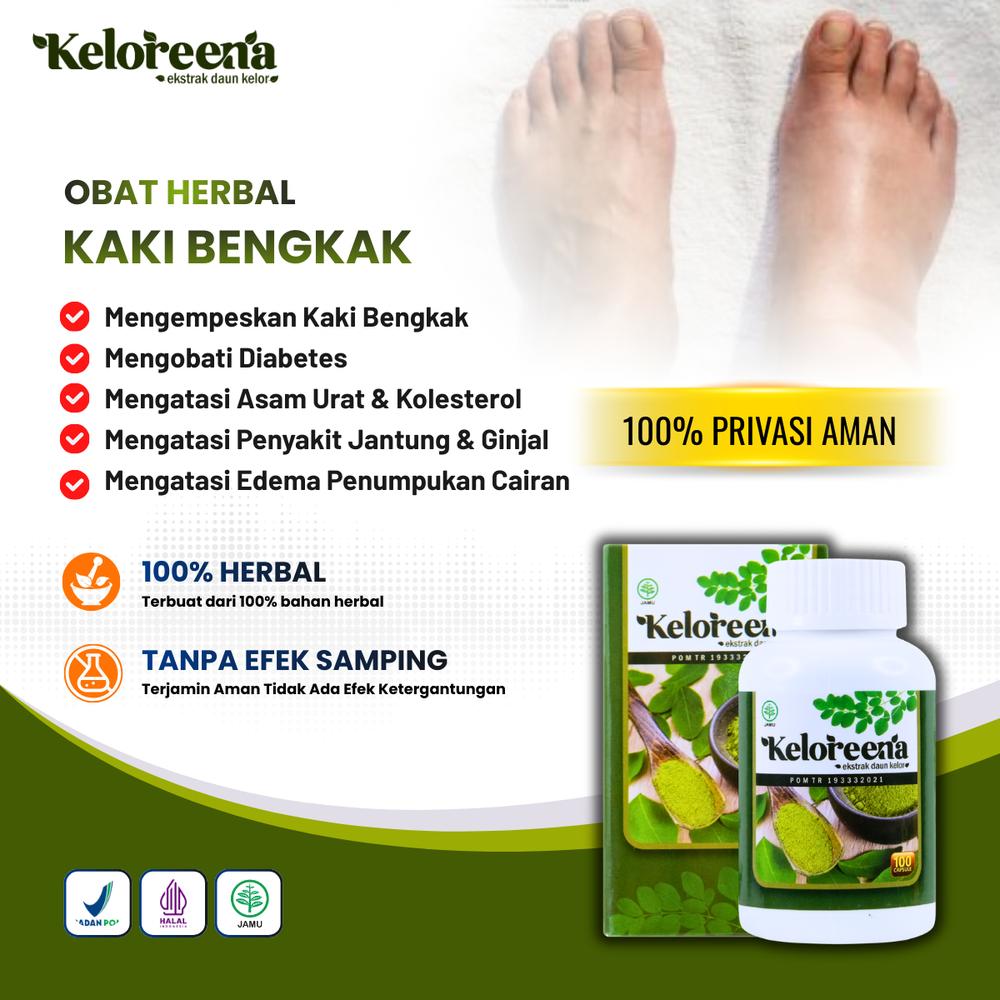 Keloreena untuk Kaki Bengkak Karena Gula / Diabetes, Asam Urat, Kolesterol, Ginjal, Jantung, Penumpukan Cairan Edema Suplemen Herbal Ekstrak Daun Kelor - 50 Kapsul