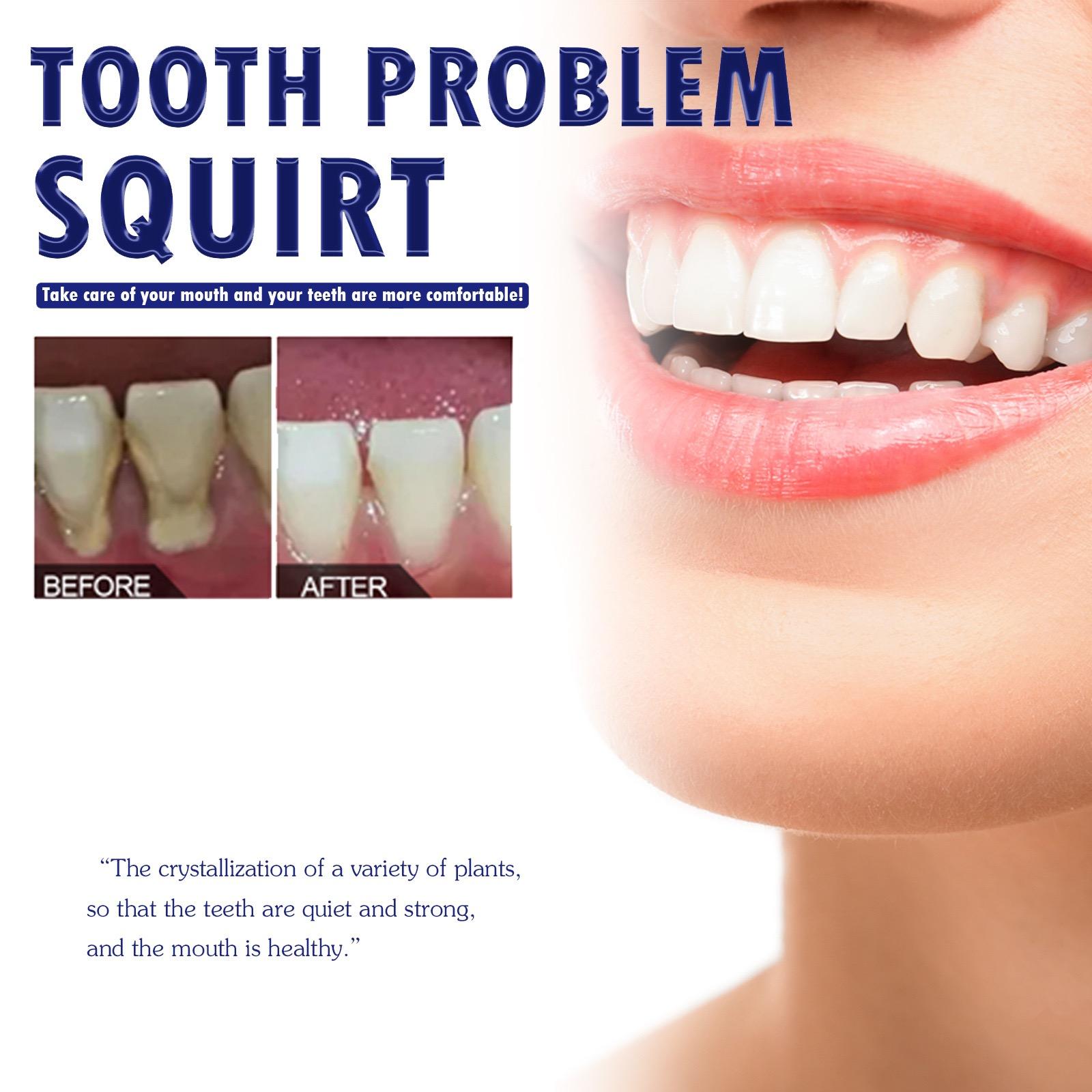 Obat sakit gigi semprot semprotan pereda nyeri obat sakit gigi berlubang obat sakit gigi berlubang ampuh 30ml Obat sakit gigi anak obat sakit gigi gusi bengkak cepat perawatan mulut pereda cacing gigi Semprotan Pereda Nyeri [J72]