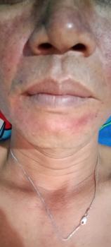 Product Review of [COD] HAN RIVER Facial & Blackhead Remover Pro - Alat Penyedot Komedo Elektrik + Perawatan Wajah, dengan USB Charger!  (Model HRMRY02WT)   Garansi 1 Tahun from i**n e**t 0