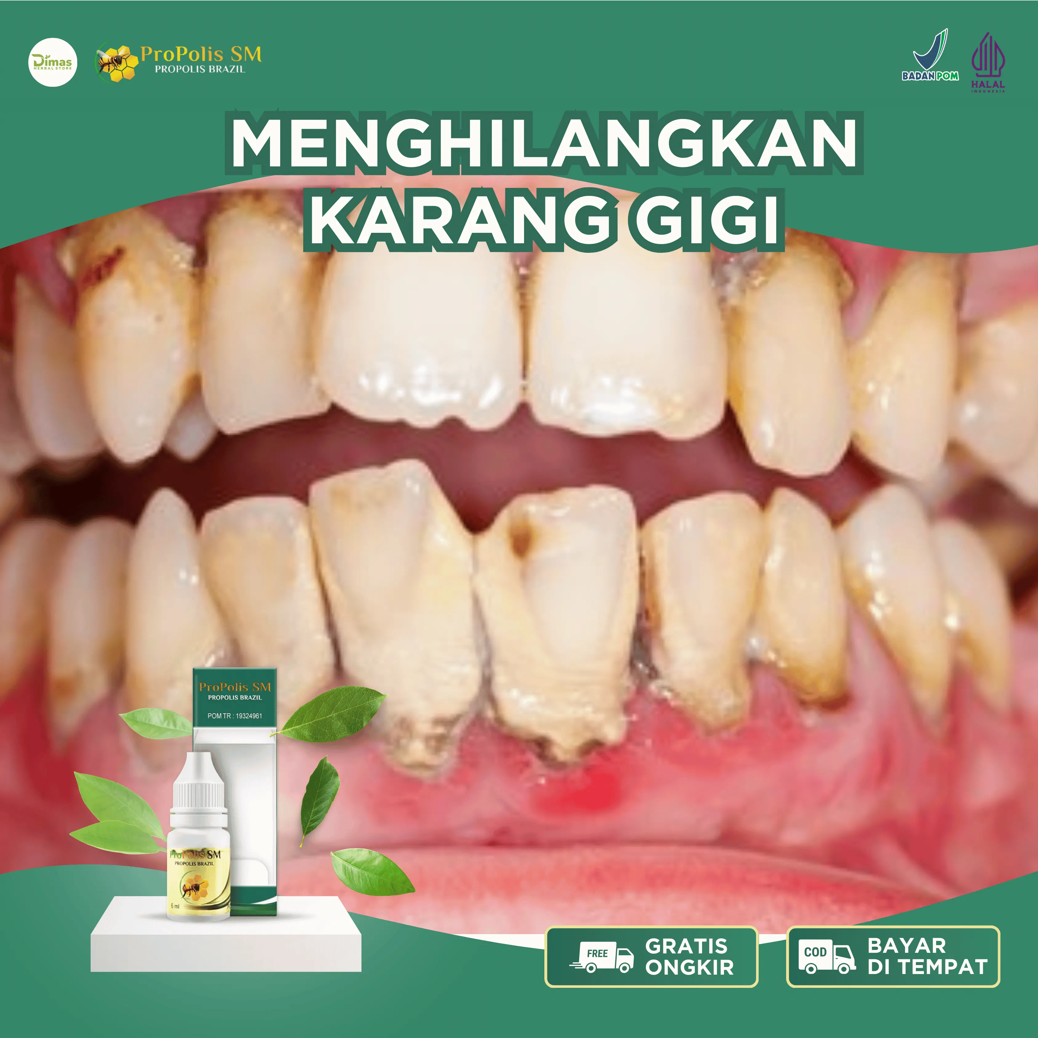Propolis SM Karang Gigi, Pembersih Karang Gigi, Karang Gigi Hitam, Karang Gigi Kuning, Pemutih Gigi, Perontok Karang Gigi, Karang Gigi Bau Mulut, Penghilang Kotoran Di Gigi