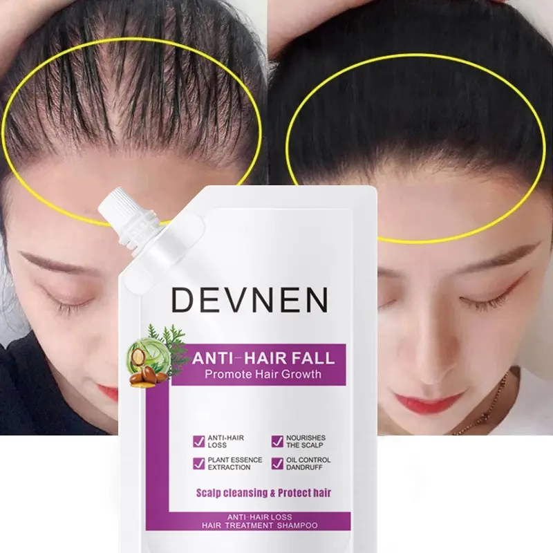 DEVNEN sampo anti rambut rontok 300ML Hair Growth Shampoo shampo penumbuh rambut cepat Anti rambut rontok Botak ginger shampoo kontrol minyak menyegarkan pelembab nutrisi Conditioner Haircare Ketombe Lebat 1