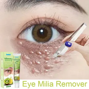 Sumifun krim herbal vitamin E penghilang milia bintik lemak fat granule mata hidung 20g krim penghilang milia syringoma xanthelasma butiran lemak sekitar mata