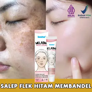 Krim penghilang flek hitam cream flek hitam membandel salep flek hitam membandel 20g menghilangkan flek hitam di wajah serum flek hitam Perawatan wajah Krim bintik Perbaikan bekas luka dan bintik bintik secara permanen dan efektif