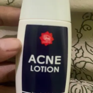 Viva Acne Lotion - 30 ML.