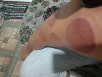 Product Review of Alat Bekam Elektrik Pintar / Alat Penghilang Cape Pegal from f**3 2